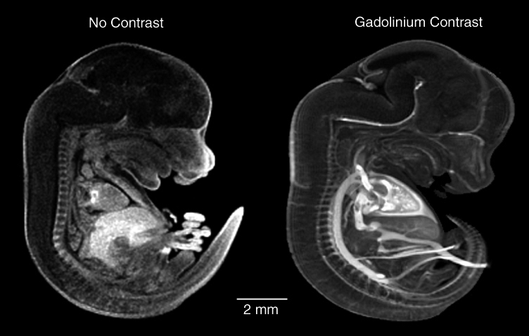 MRI with and without vasculature contrast agent