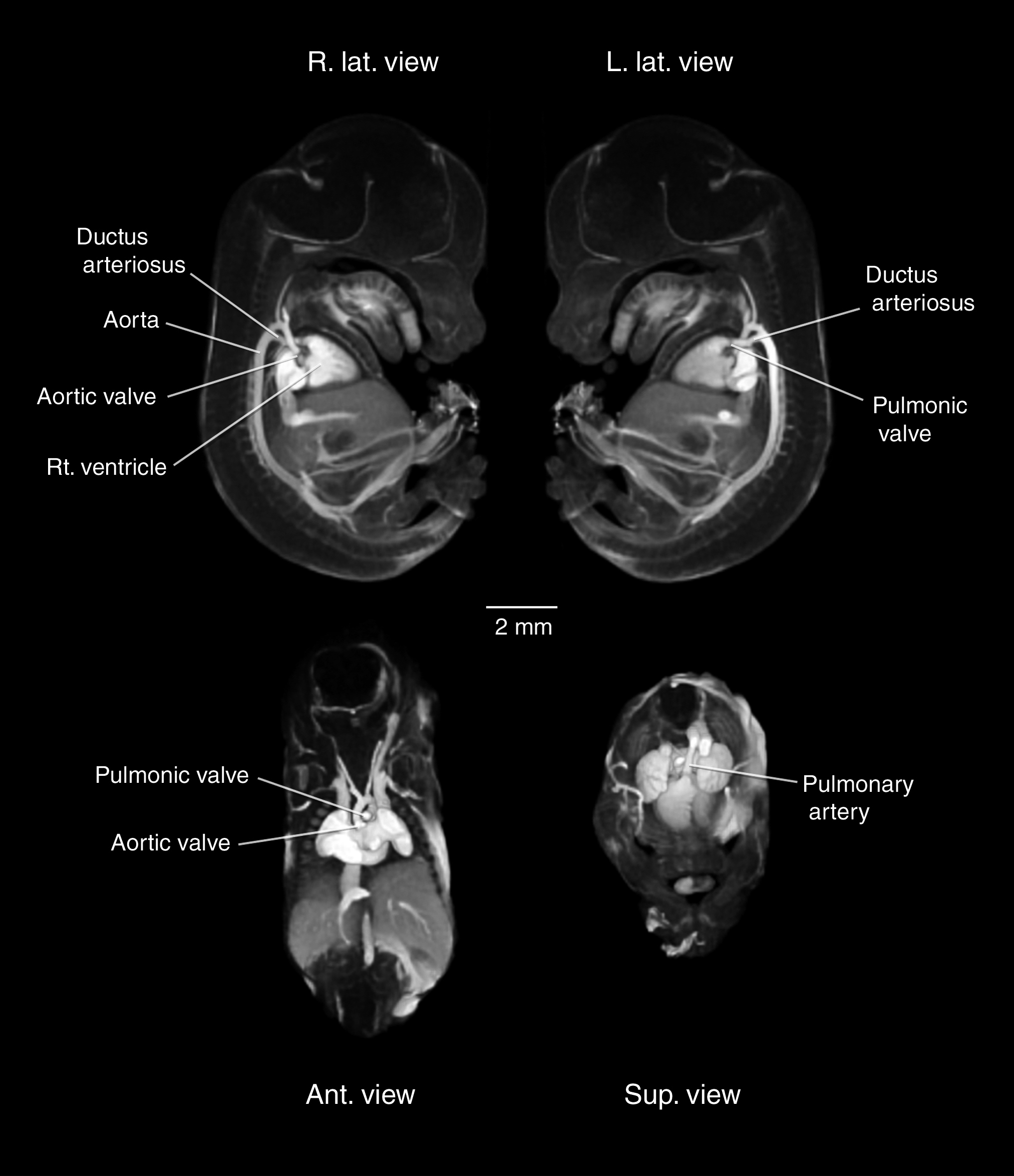 MRI showing vasculature