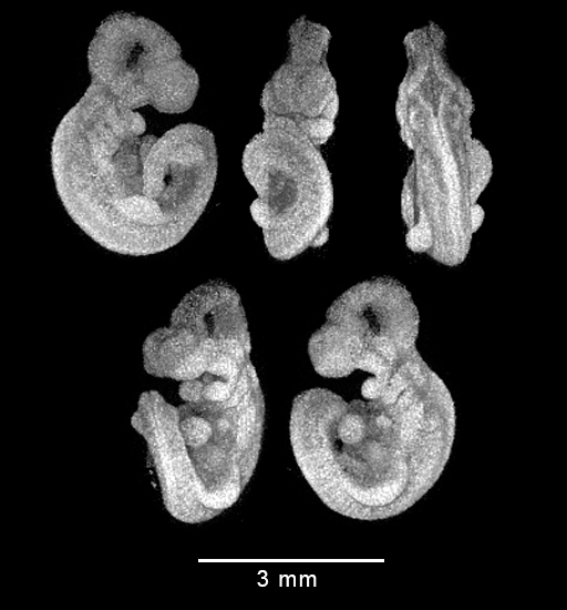 four MRI views of mouse embryo