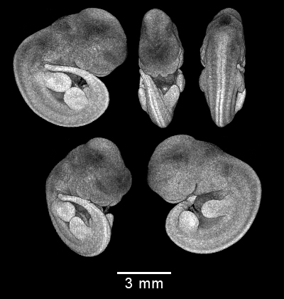 four MRI views of mouse embryo
