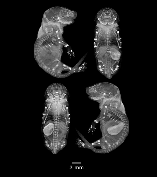 four MRI views of mouse embryo