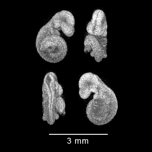 four MRI views of mouse embryo