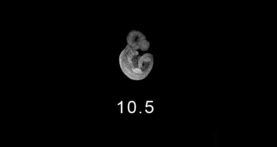 day 10.5 Embryo Image
